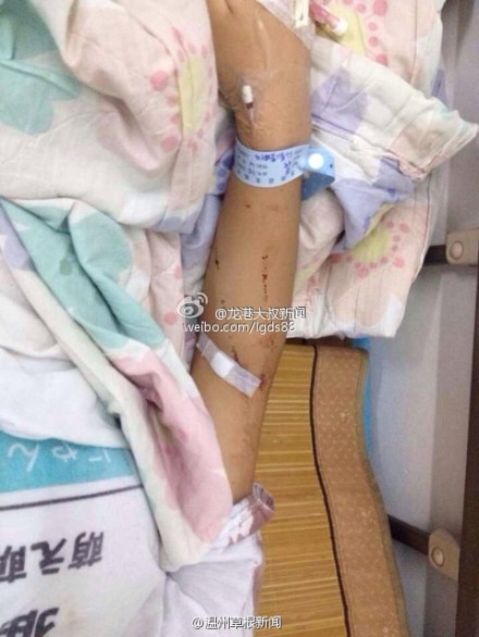 蒼南一中學女生拿剪刀捅傷同學