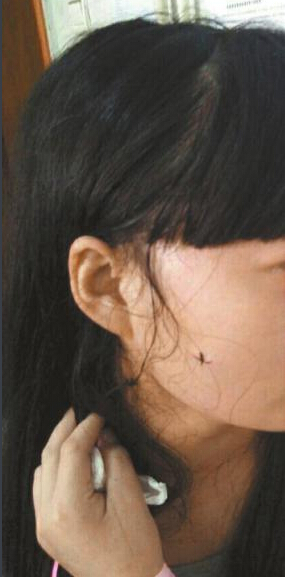 拒陪室友聊天被劃傷5刀