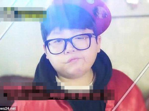 男子患不老癥