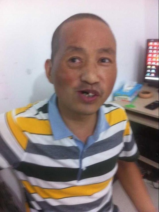 男子購(gòu)刀自切腫瘤