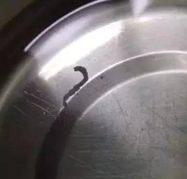 寧波女子喝蛇血體內長了一條3厘米的寄生蟲