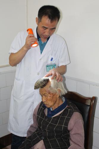 老太頭上長出獨角