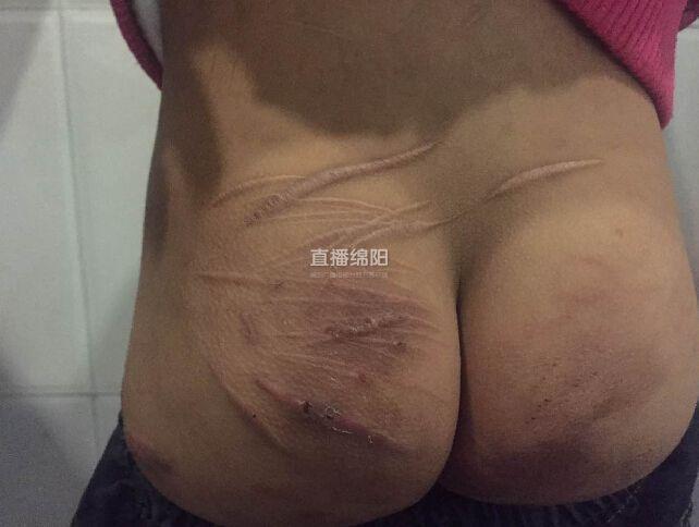 女孩被養(yǎng)父母虐待