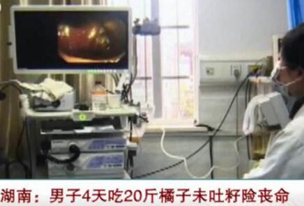 吃20斤橘險喪命 不吐籽危險